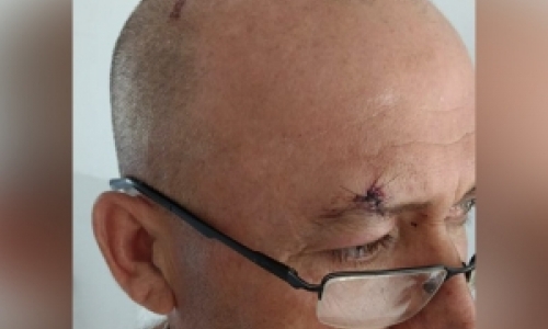 Homem é agredido em tentativa de assalto em frente a casa noturna