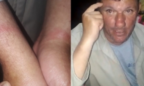 Deficiente diz ter sido agredido por policial ao urinar no muro da delegacia