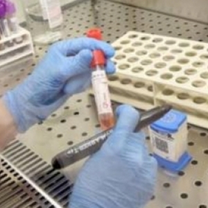 Boletim oficial informa quatro casos suspeitos de novo coronavírus sendo investigados