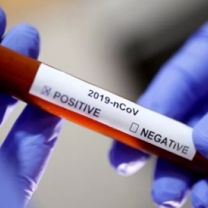 Sobe para 28 o número de casos de novo coronavírus no Estado