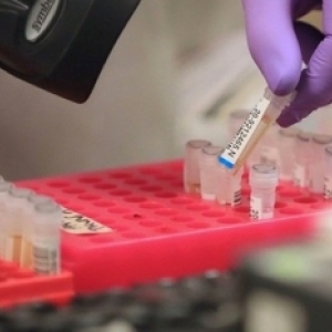 Itapema confirma mais um caso de novo coronavírus na cidade