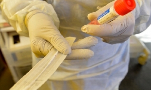 Sai resultado do teste de servidor público afastado com sintomas respiratórios