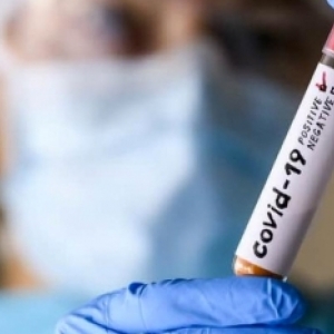 Municípios vizinhos registram mais casos de novo coronavírus