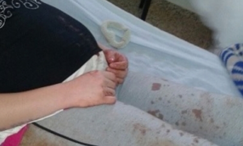 Grávida de 6 meses é agredida pelo marido a golpes de faca