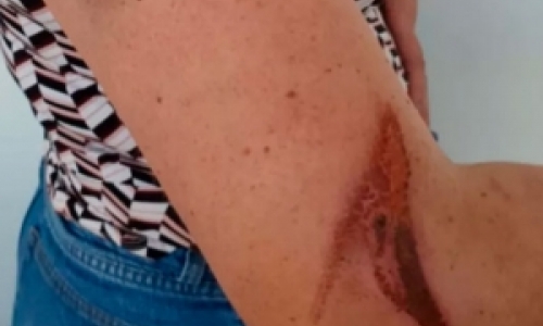 Briga entre vizinhos quase termina em agressões com golpes de facão