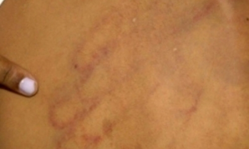 Com arma apontada para a cabeça da esposa, marido agride mulher
