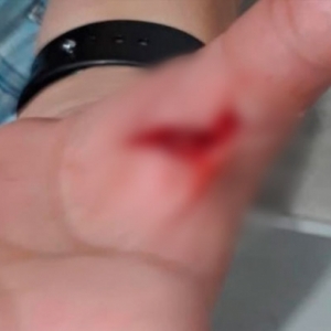 Fim de semana registra diversos casos de violência e agressões 