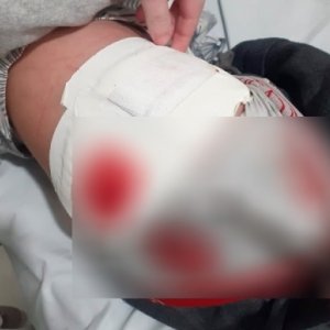 Ex-vereador de Tijucas é preso por atirar contra crianças e deixar menino de 11 anos ferido