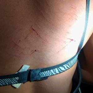 Mulher é agredida por familiares e sofre lesões; parentes não querem ela em casa