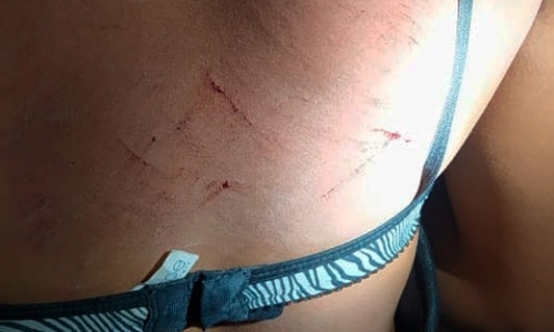 Mulher é agredida por familiares e sofre lesões; parentes não querem ela em casa