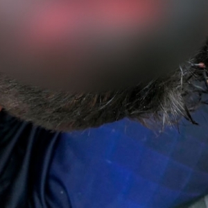 Durante discussão filho é agredido pela mãe com paulada na cabeça