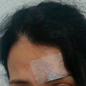 Ciclista tem ferimentos graves provocados por linha de cerol esticada em ciclovia