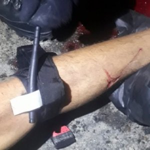 Vítima de acidente tem vida salva graças a torniquete improvisado