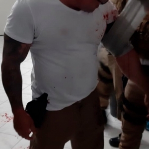 Tenente Coronel Eder explica imagens onde aparece com ferimento e manchas de sangue