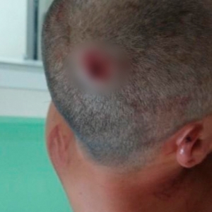 Homem atira seis vezes contra cabeça de vítima durante discussão