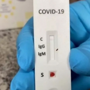 Funcionários positivados; posto de atendimento de identificação é fechado