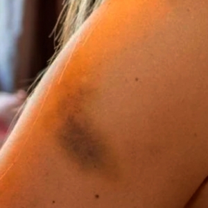 Criança nega dar tablet para mulher e ela é agredida pelo companheiro