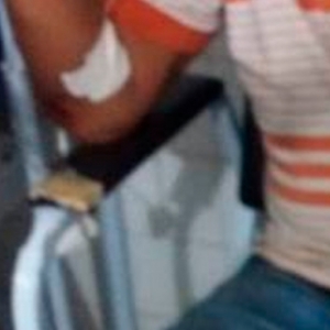 Ex-funcionário esfaqueia dono de restaurante em assalto