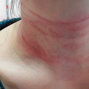 Flagrante de violência doméstica; vítima encontrada com lesões junto do autor