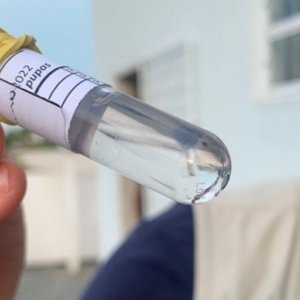Após situação grave, cidade completa duas semanas sem casos de dengue 