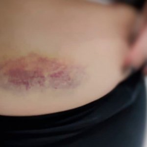 Mulher mantida em cárcere e estuprada pelo companheiro é resgatada em Itapema