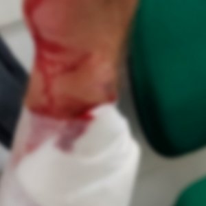 Homem tenta matar proprietário de bar que não aceitou nota falsa como pagamento