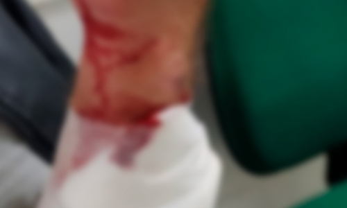 Homem tenta matar proprietário de bar que não aceitou nota falsa como pagamento