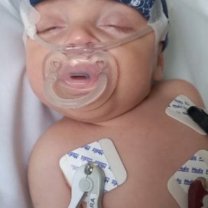 Com apenas dois meses de vida, bebê de Tijucas é internado com pneumonia