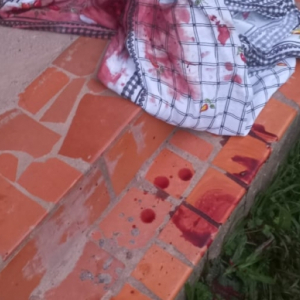 Mulher é brutalmente espancada a golpes de facão por companheiro