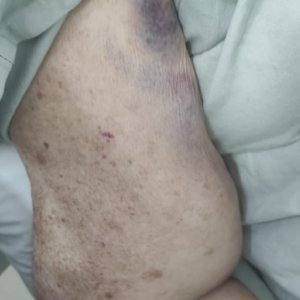 Coren irá investigar denúncia de agressão contra idosa em hospital