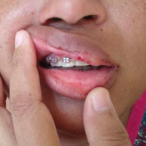 Mulher fica ferida ao ser agredida pelo companheiro durante discussão 