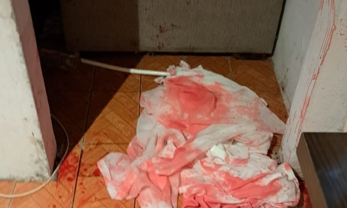 Mãe é esfaqueada diversas vezes pelo companheiro ao tentar salvar filha de estupro