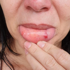 Mulher sofre lesões ao ser agredida com socos e chutes pelo marido