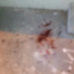 Mulher embriagada é esfaqueada após discutir com desconhecida