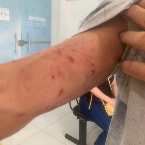 Adolescente é encaminhada ao IPQ após agredir o companheiro