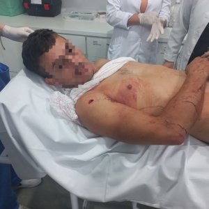 Esfaqueado pela segunda vez, marido não quis denunciar a mulher em São João Batista 