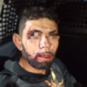 Suspeito fica com rosto ferido ao ser flagrado tentando furtar carro