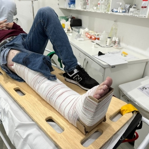 Colisão entre veículo e motocicleta resulta em perna quebrada 