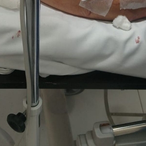 Tentativa de feminicídio: mulher é esfaqueada pelo marido após briga por criança