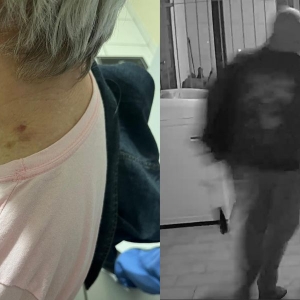 Mulher de 79 anos é agredida e tem televisores roubados em Tijucas