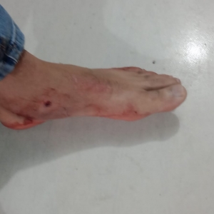 Morador que tentou matar vizinho é preso ferido com tiro no pé
