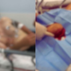 Duas facadas: Homem de 41 anos sofre ataque e fica em estado grave