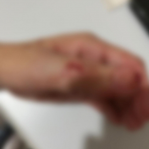 PLANTÃO: Homem é preso em flagrante em Tijucas após ferir mulher com faca 