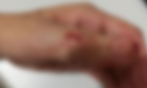 PLANTÃO: Homem é preso em flagrante em Tijucas após ferir mulher com faca 