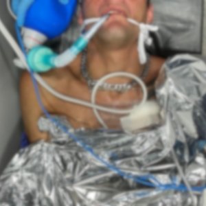 Entubado em estado grave, homem é vítima de tentativa de homicídio
