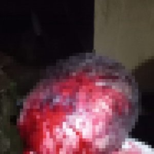 Vítima reage a assalto e é violentamente agredida na cabeça por um dos criminosos