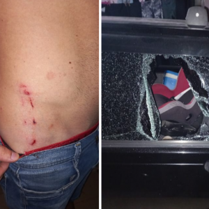 Homem de 29 anos é agredido com barra de alumínio pela ex-mulher em Nova Trento