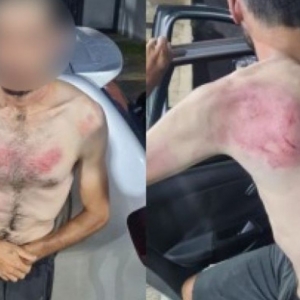 Justiça decreta prisão de dois guardas acusados de agressão contra deficiente 