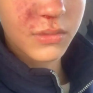 Adolescentes são agredidos após andarem de skate em área proibida em praia