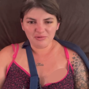 Jovem que sofreu grave acidente de moto em Tijucas já está se recuperando e agradece apoio